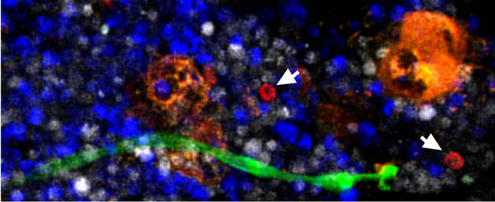 blood stem cell