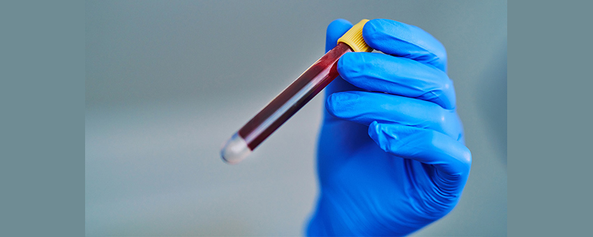 an image of a hand wearing a blue glove and holding a vial filled with blood
