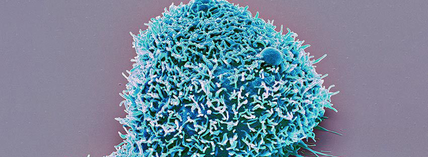 image of microscopic kidney cell stained blue
