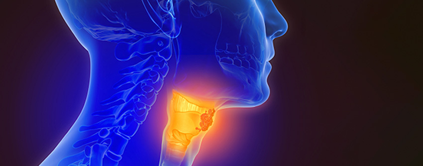 silhouette of a head in blue with the head and neck cancer highlighted