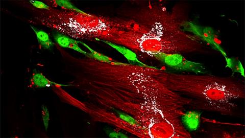 Immunofluorescence image shows breast cancer cells (green) aligned with mesenchymal stem cells (red) expressing DDR2 protein (white)