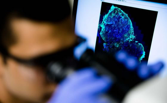 photo of a researcher looking at a scan of a breast cancer tumor