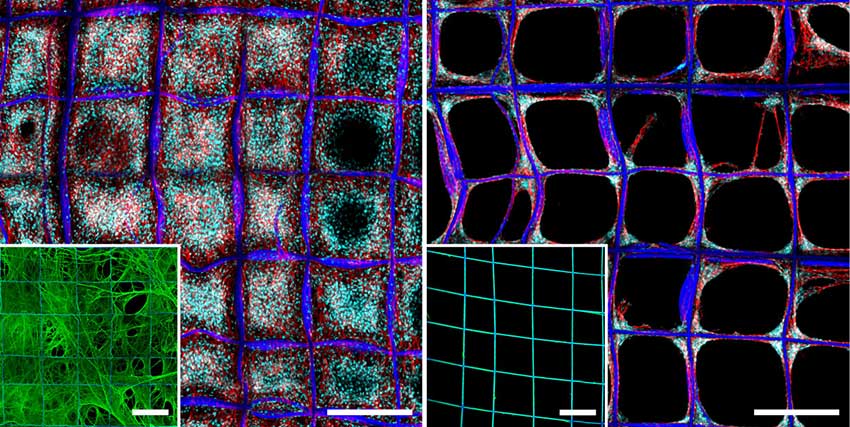 image of 3D scaffold and cancer cells