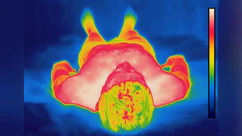 a heat-map version of the human body