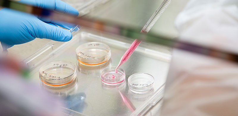 image of someone using a pipette to add fluid to petri dish