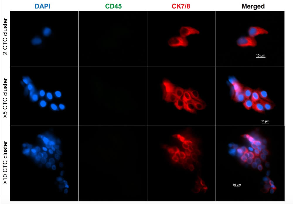 lung cancer cells