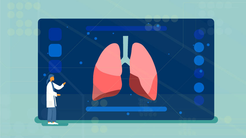 graphic representation of a pair of lungs being screened