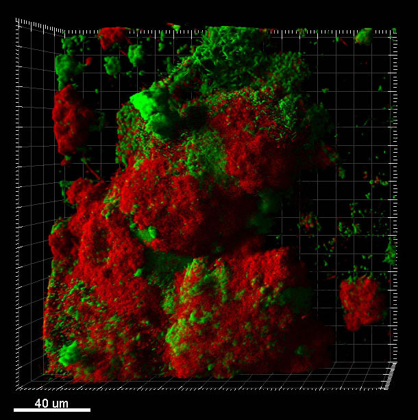 Nisin-treated oral biofilm