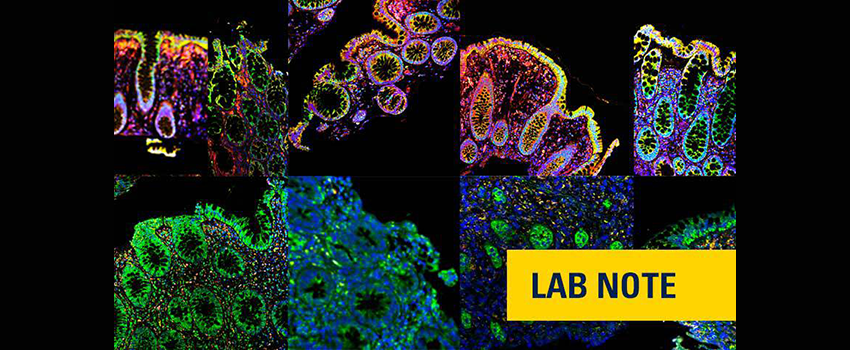 colorful variety of immune cell photos combined into one