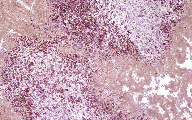 images of a mouse melanoma tumor cell
