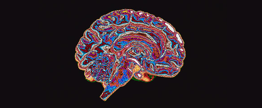 colorized image of a brain on black background