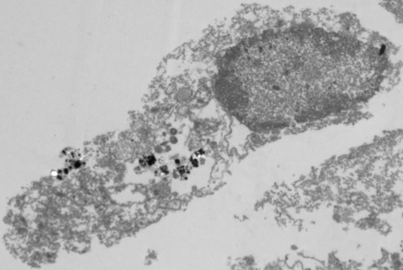 Nanoparticle