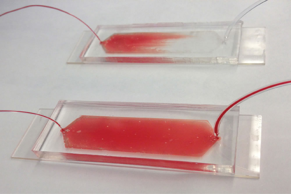 image of blood samples