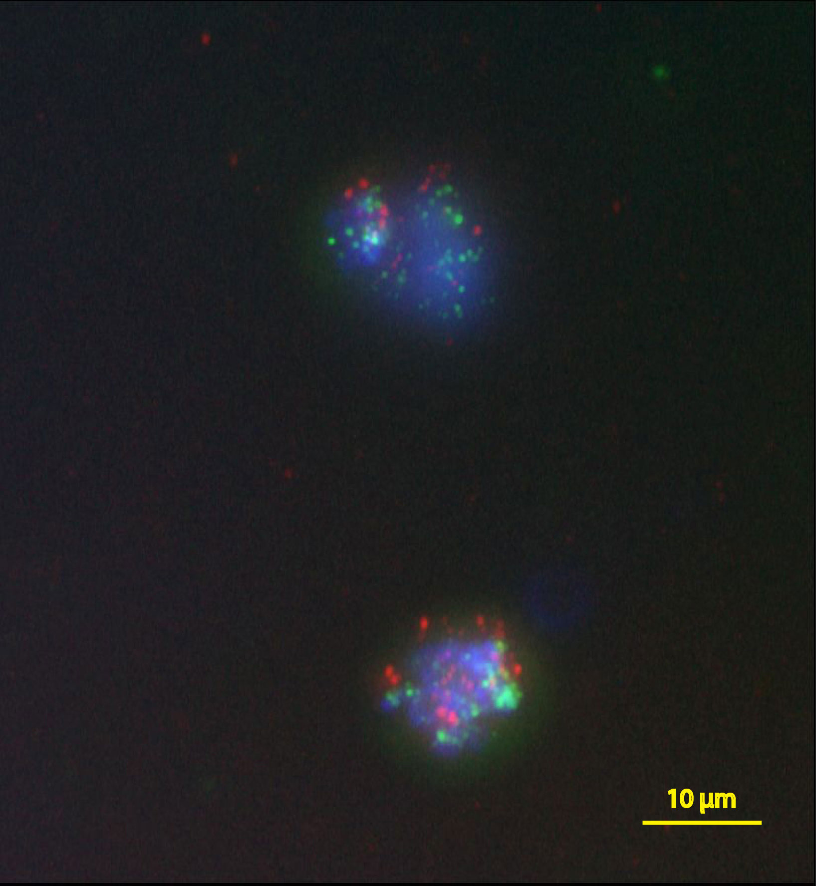 cancer releasing cells found in blood biopsy