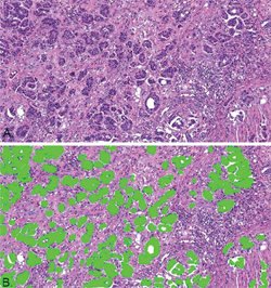 Software for analyzing digital pathology images proving its usefulness