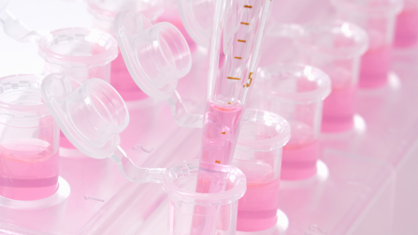 image of test tubes and pipette