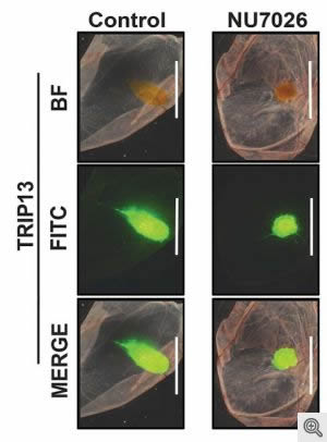 image of squamous cells