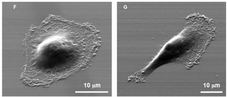 Individual cancer cells were isolated with a new device. The cell on the left is less likely to metastasize.