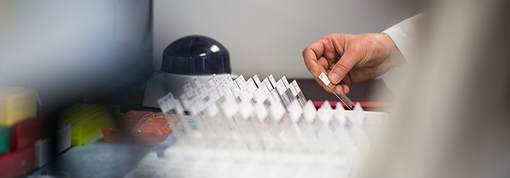 a tray of biological samples