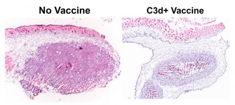 dead cancer cells on the right and cells not given vaccine on the left