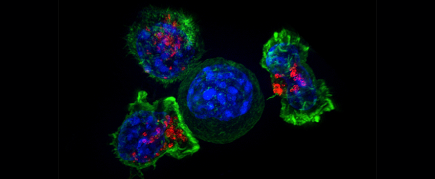 microscopic blue and green cancer cells