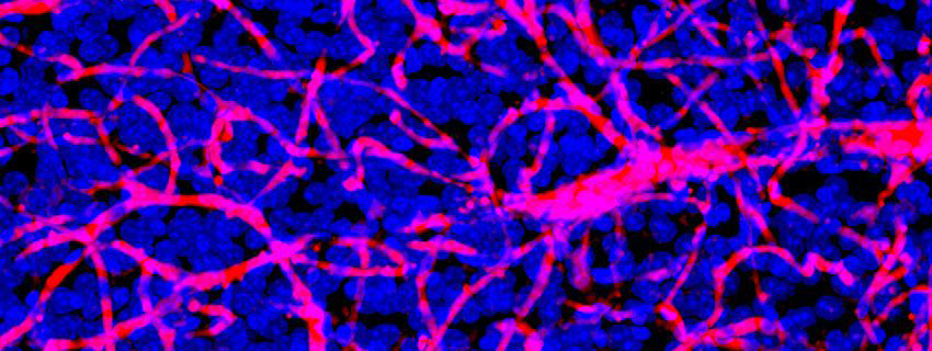 colorful image of blood vessels and nuclei depicting the blood-brain barrier