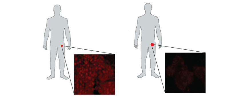 Silhouette with a zoom-in look at groin area showing before and after prostate cells
