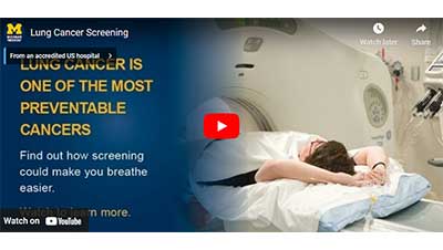Image of the YouTube player and the intro to Lung Cancer Screening