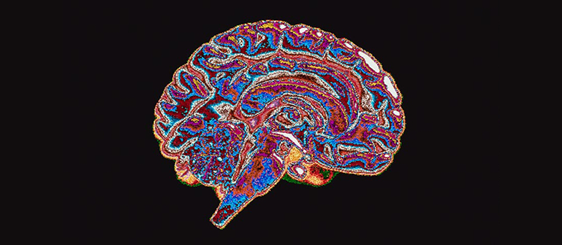 Cross section of a brain