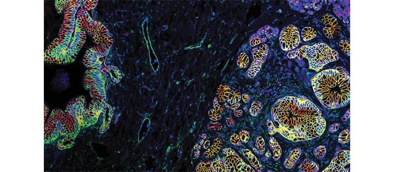Colorful images of pancreatic cells
