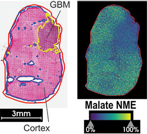 Comparison of glioblastoma cells in a mouse brain in standard versus mass spectrometry