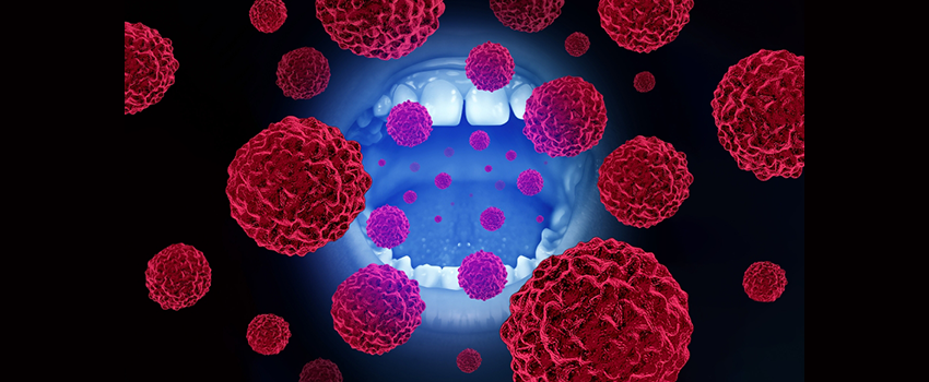 Oral cancer cells surround the image of an open mouth