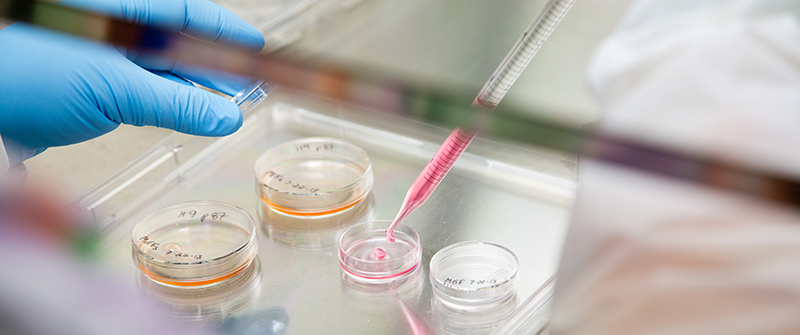 photo of a lab technician using a pipette to place a drop on a petri dish