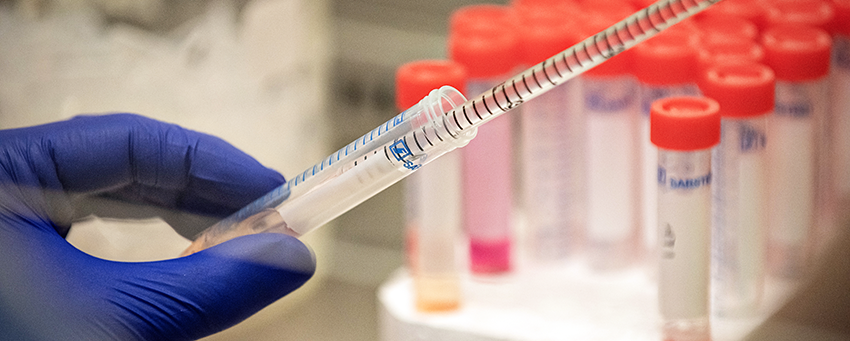 close-up of a person using a pipette to transfer biological sample into a container