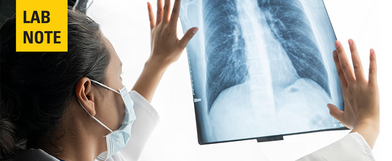 female doctor looking at lung x-ray