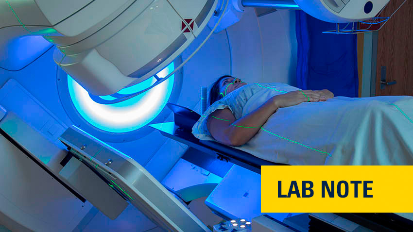 Research shows side effects of radiation therapy are reduced when